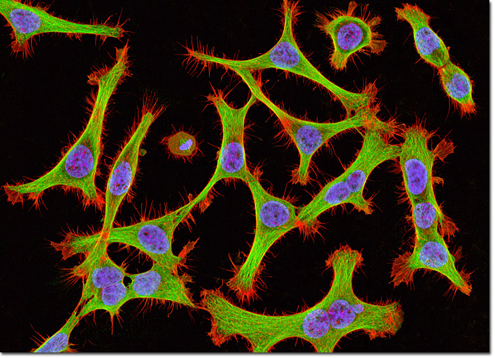 Komórki Hela w mikroskopie fluorescencyjnym.